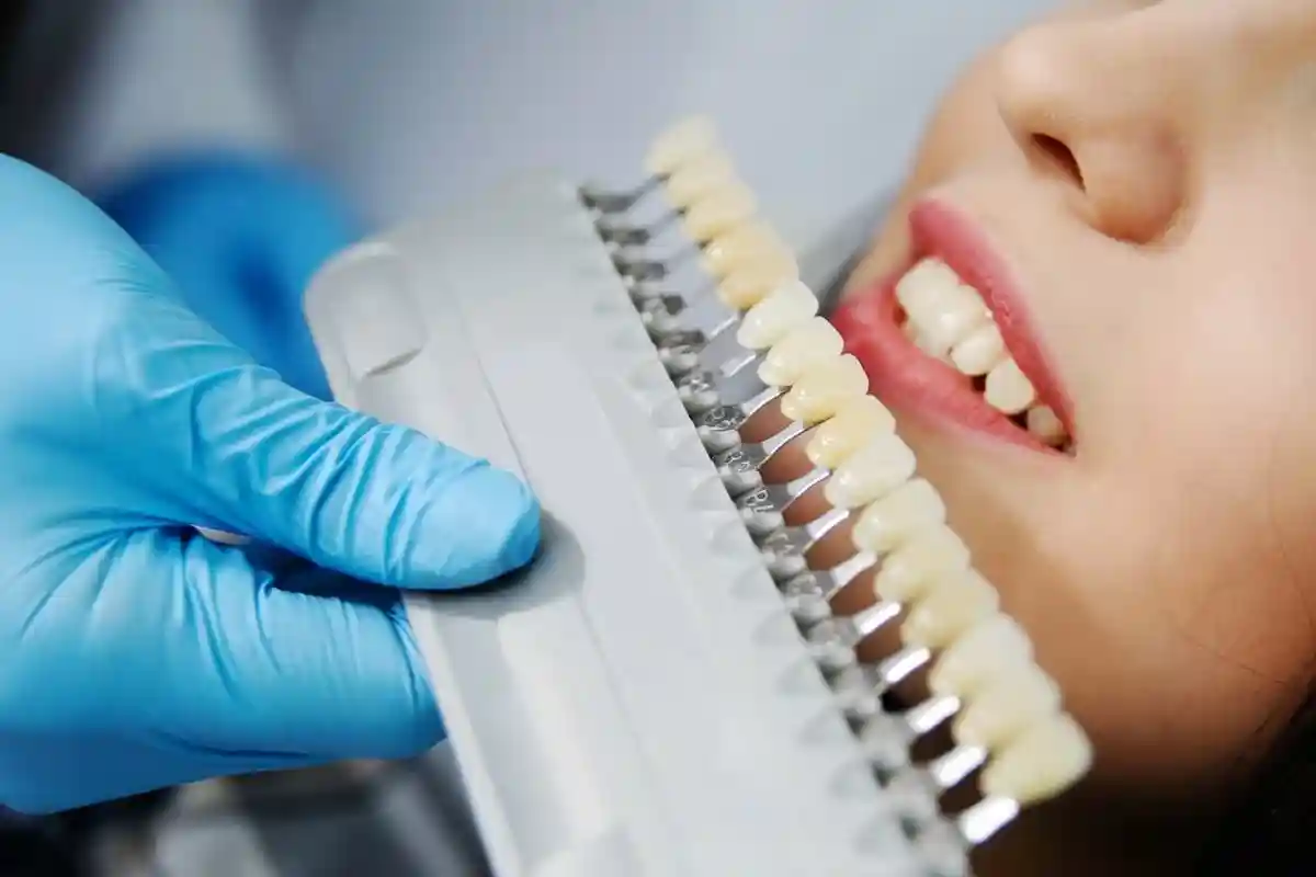 Сейчас стоматологи вообще не советуют подбирать пломбу непременно белого цвета. Не у всех зубы от природы отличаются идеальной белизной, и в некоторых случаях пломба просто будет смотреться неестественно. Фото: shutterstock.com