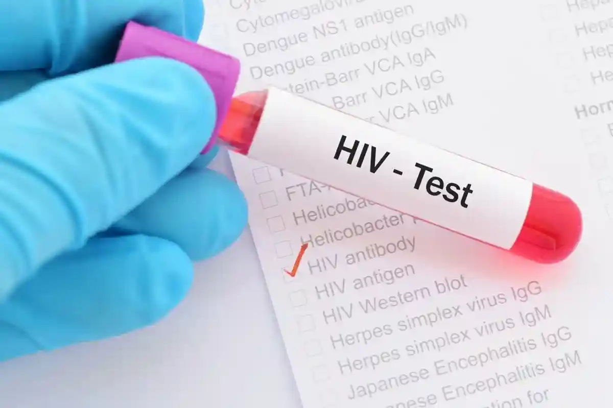 экспресс-тест на ВИЧ в Германии