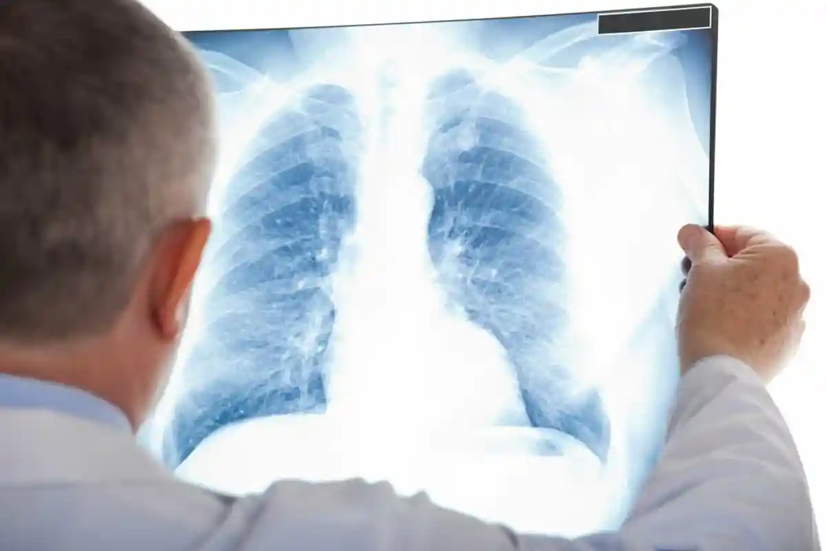 Врач смотрит на рентген лёгких фото