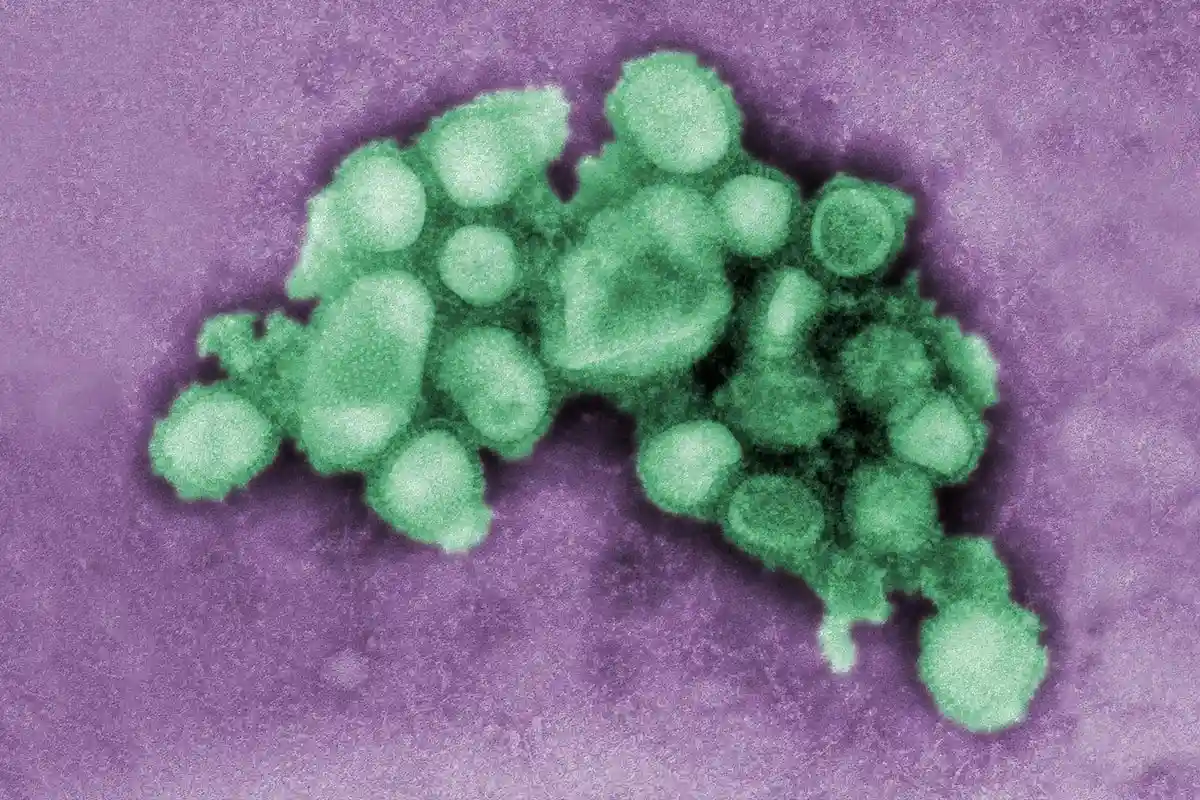 Вирус свиного гриппа под микроскопом. Фото: CDC / Unsplash.com