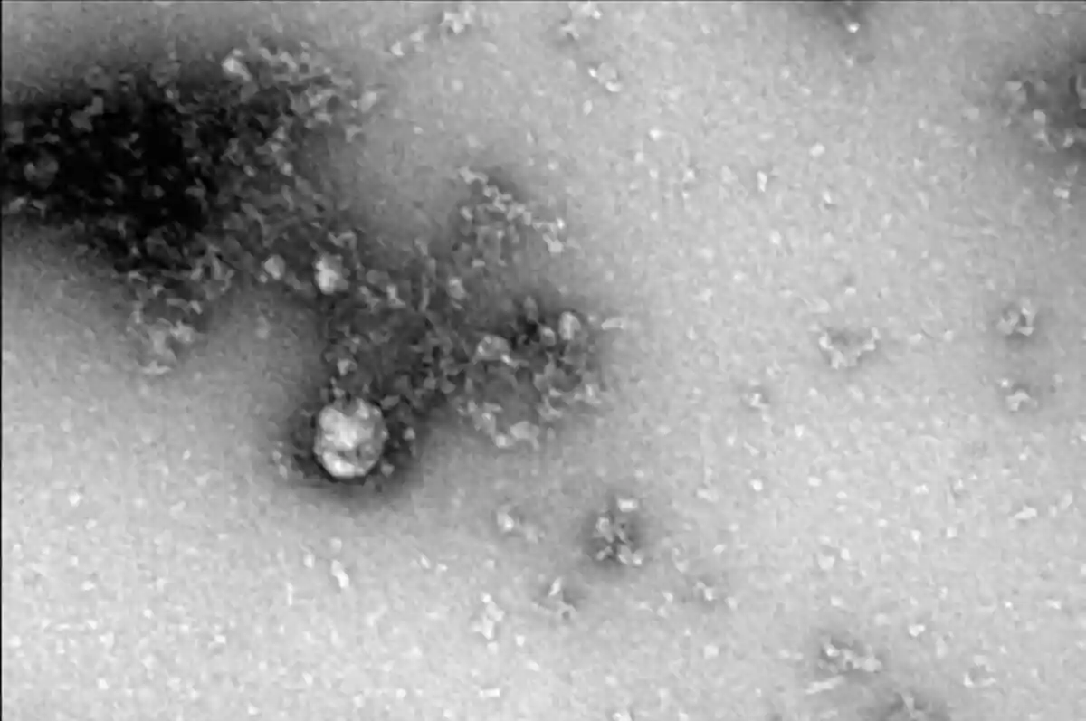 Новый дельта-штамм коронавируса Фото: rospotrebnadzor.ru