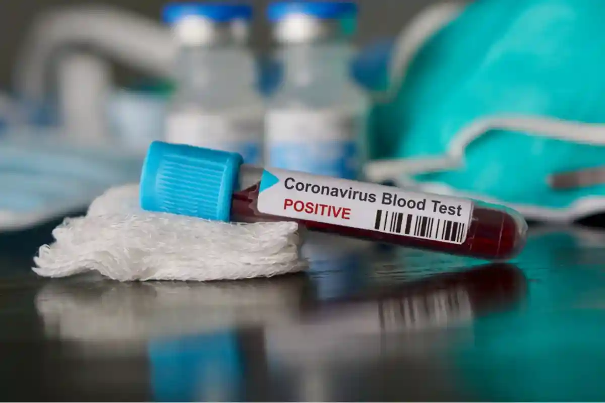 Положительный результат анализа крови на коронавирус Фото: SamaraHeisz5/Shutterstock.com