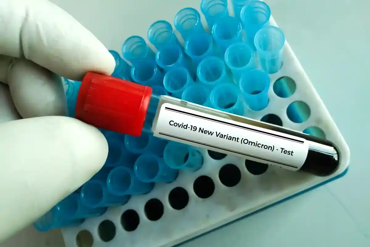 Врач в лаборатории держит образец нового штамма коронавируса «Омикрон» Фото: Arif biswas/Shutterstock.com