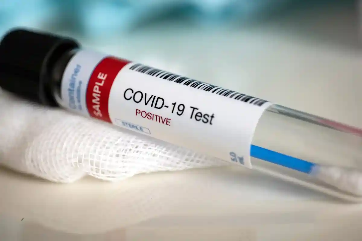 положительный тест на коронавирус Фото: Myriam B/Shutterstock.com