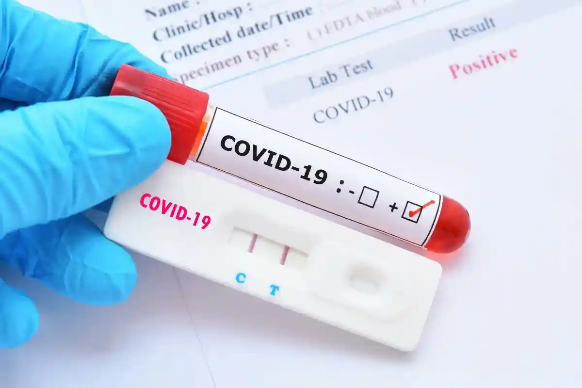 Новый штамм коронавируса «Омикрон» был обнаружен у невакцинированного путешественника, который въехал в Бельгию и 22 ноября сдал положительный тест на коронавирус. Фото: Jarun Ontakrai / Shutterstock.com