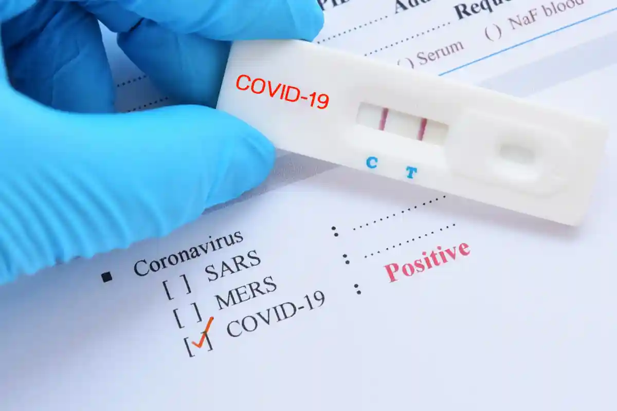 Новый препарат Lagevrio (Molnupiravir) следует начинать принимать сразу после положительного теста на коронавирус. Фото: Jarun Ontakrai / Shutterstock.com