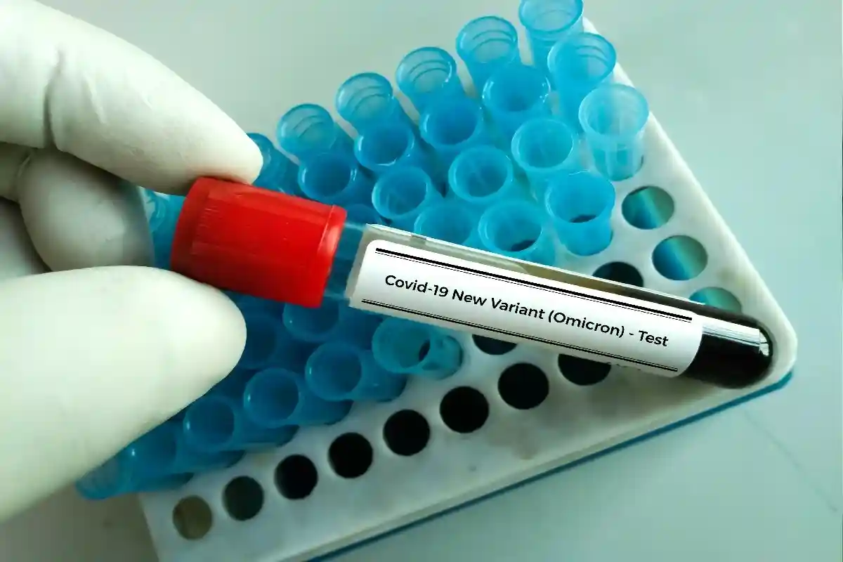 Гернот Маркс подчеркнул, что на данном этапе информации о новом штамме коронавируса «Омикрон» недостаточно. Фото: Arif biswas / Shutterstock.com 