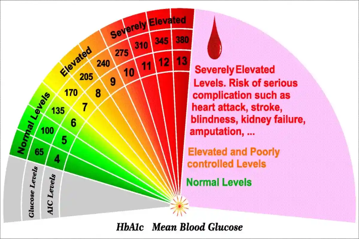 Если показатели сахара, находятся в пределах от 99 до 120 мг/дл или от 5,5 до 7 ммоль/л, то высока вероятность наличия у вас приобретенного диабета второго типа. Фото: Fouad A. Saad / shutterstock.com