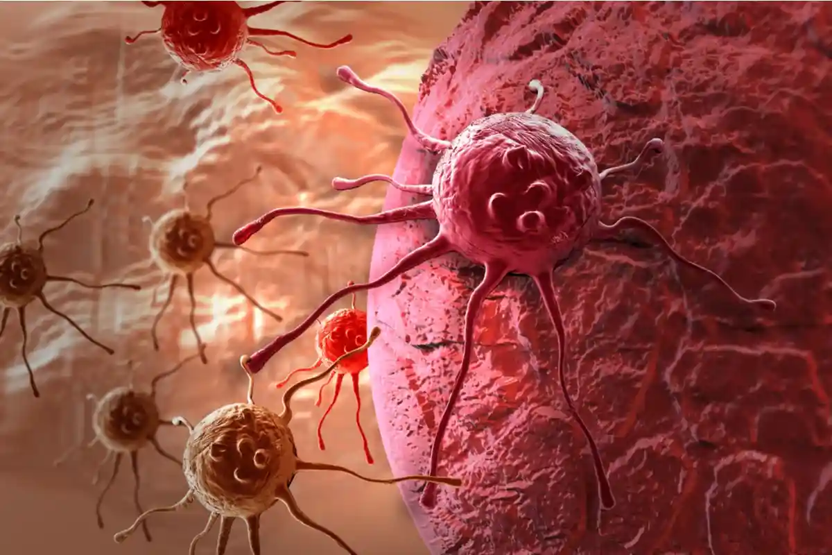 Так выглядит раковая клетка Фото: jovan vitanovski / Shutterstock.com