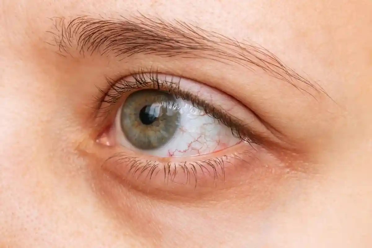 Неожиданный симптом в глазах указывает на «Омикрон»