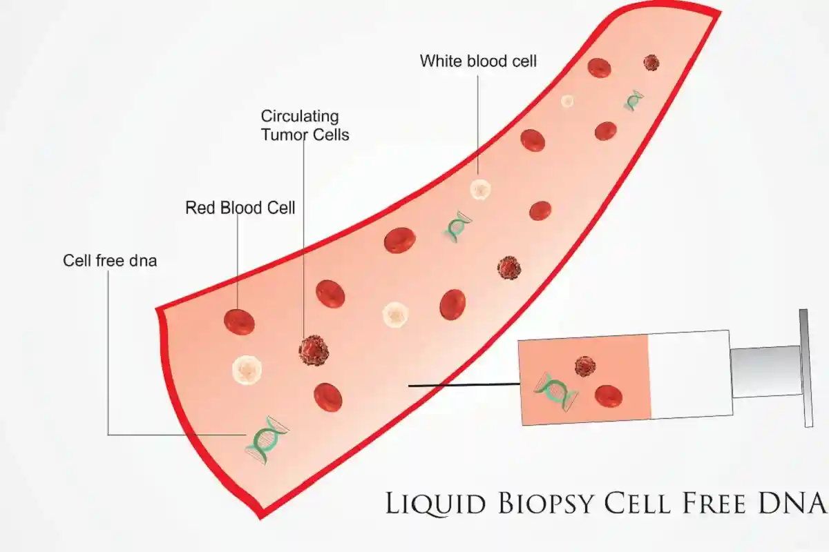 Усовершенствованное секвенирование нуклеиновых кислот позволяет обнаружить материал опухолевых клеток в простом образце крови. Фото: Abhinav Chaudhary / shutterstock.com
