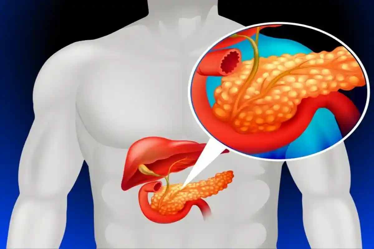 Лекарства от артериального давления могут помочь снизить смертность от рака поджелудочной железы