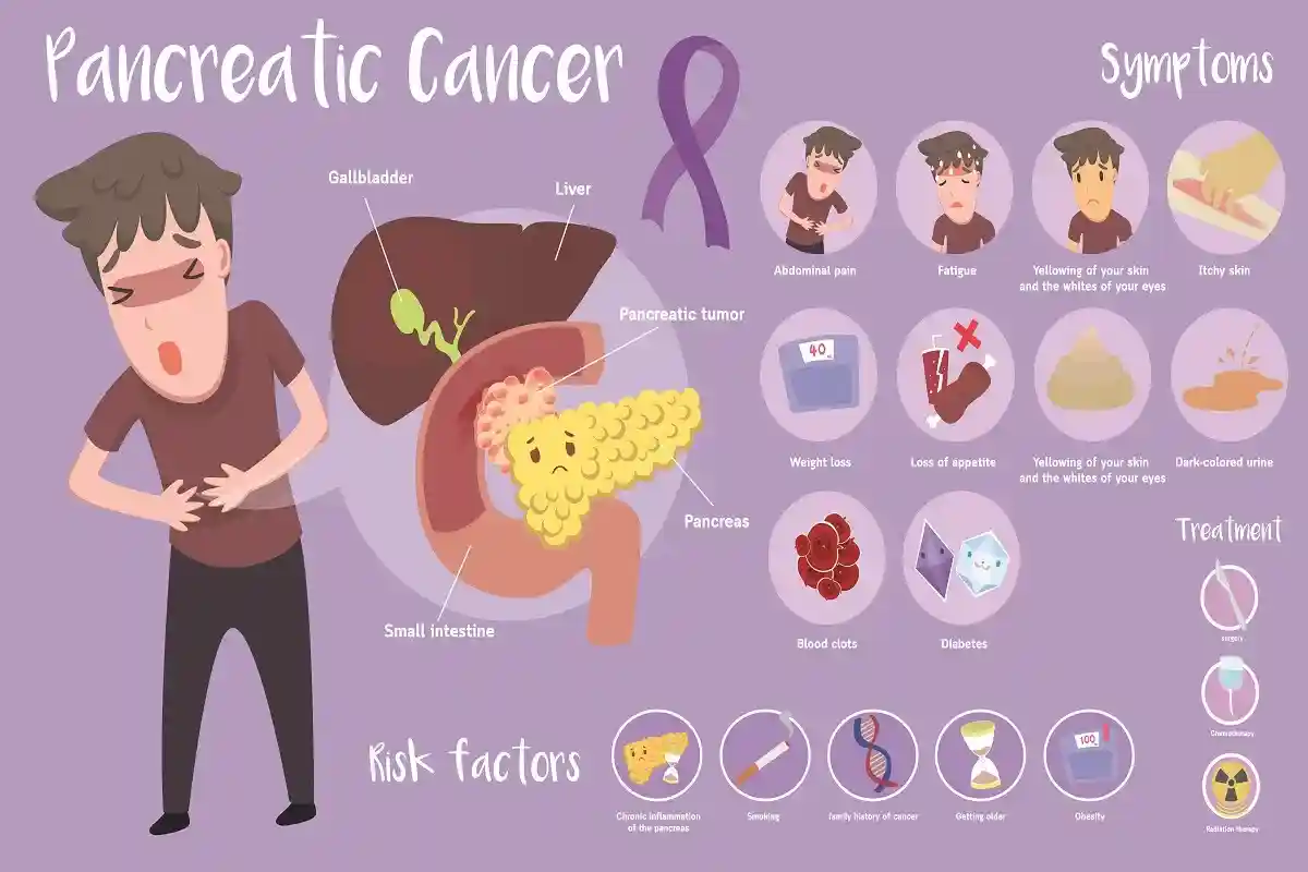 Большинство симптомов не является специфичными для рака поджелудочной железы. Фото: nekoztudio / shutterstock.com