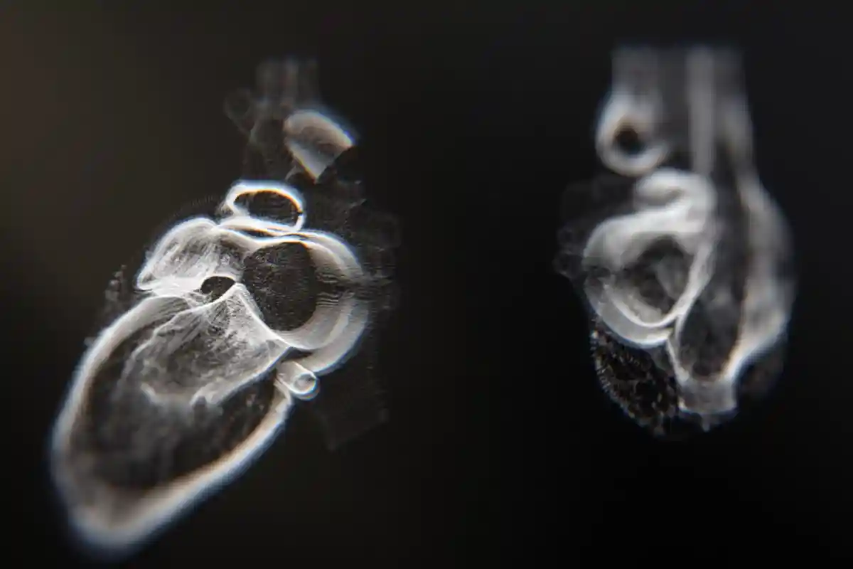 Сканирование сердца аппаратом МРТ помогает выявить заболевания на ранней стадии Фото: SquareMotion / Shutterstock.com