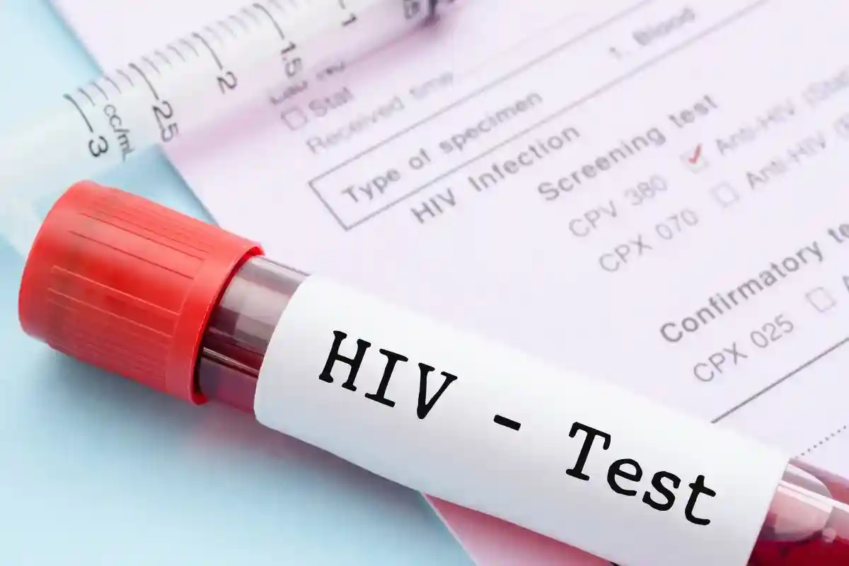 "Любое понимание ВИЧ, которое могло бы оправдать этот запрет, устарело и противоречит современной науке". Фото: PENpics Studio / shutterstock.com