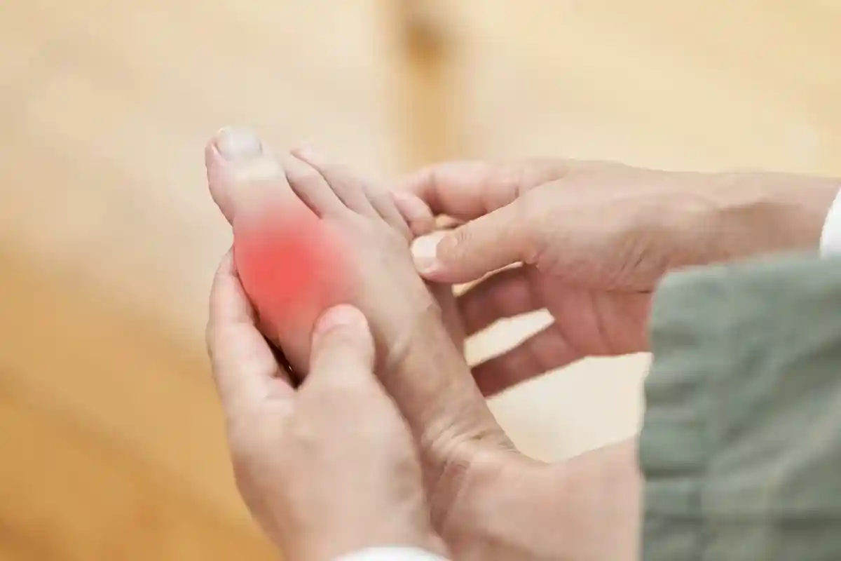 Многие пациенты с сердечной недостаточностью также страдают подагрой — видом артрита, вызванного скоплением кристаллов мочевой кислоты в суставах.. Фото: mapo_japan / shutterstock.com