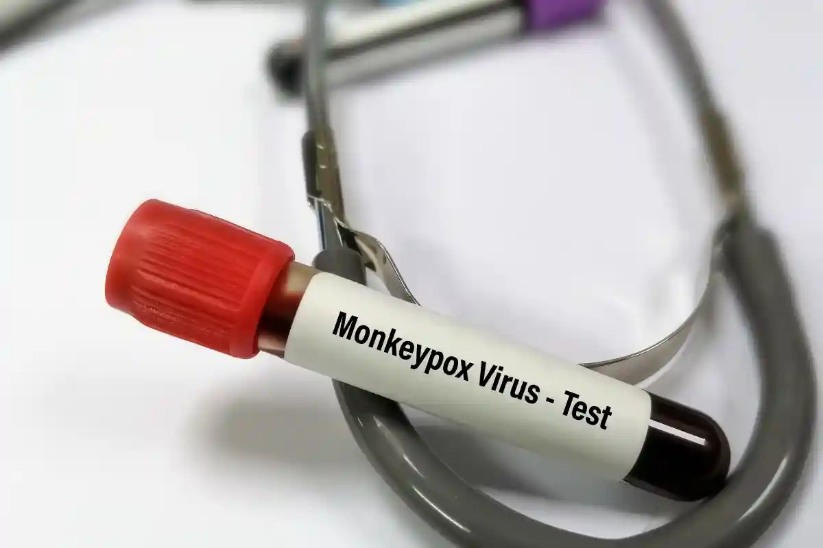 В ВОЗ рассказали, будет ли пандемия оспы обезьян. Фото: Saiful52 / Shutterstock.com