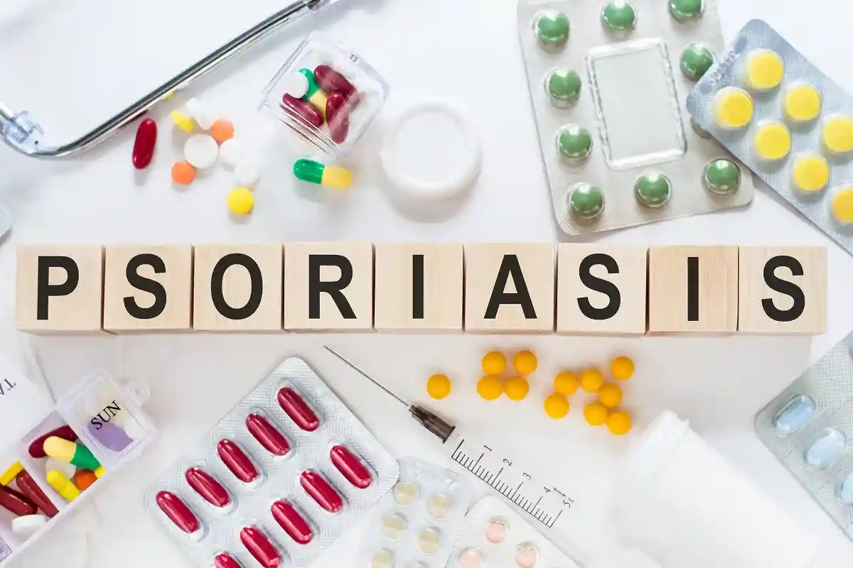 Пока нет лекарства от псориаза, но соответствующие методы лечения могут облегчить симптомы.