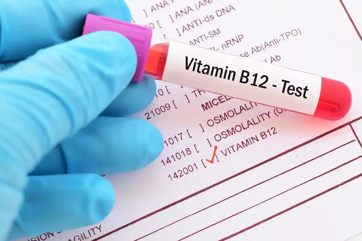 Тест на уровень витамина В12. Фото: Jarun Ontakrai / shutterstock.com