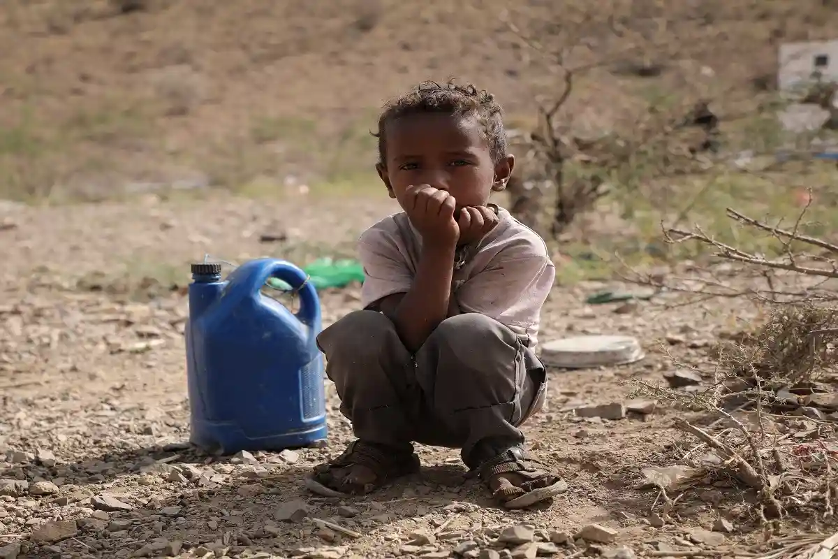 Дети в Йемене оказались на пороге голода. Фото: Akramalrasny / Shutterstock.com