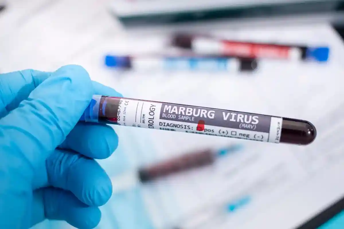 Вирус Марбург: что стоит знать о «родственнике» Эболы