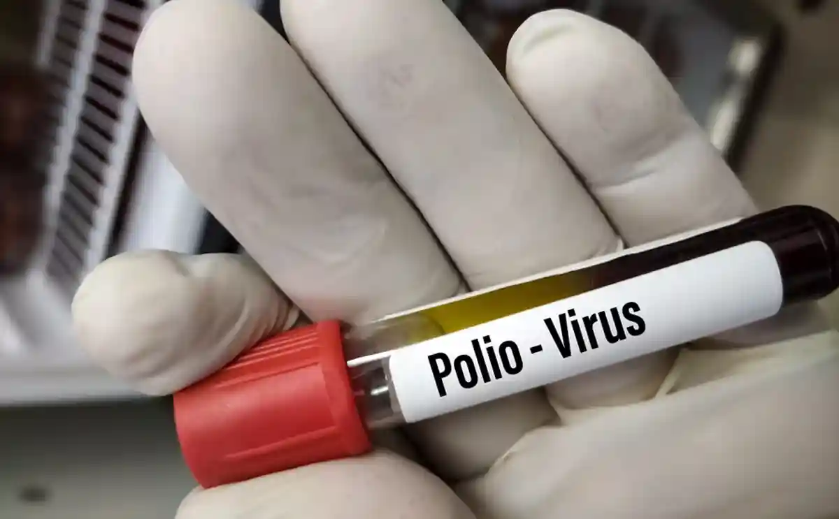 Вирус полиомиелита в США
