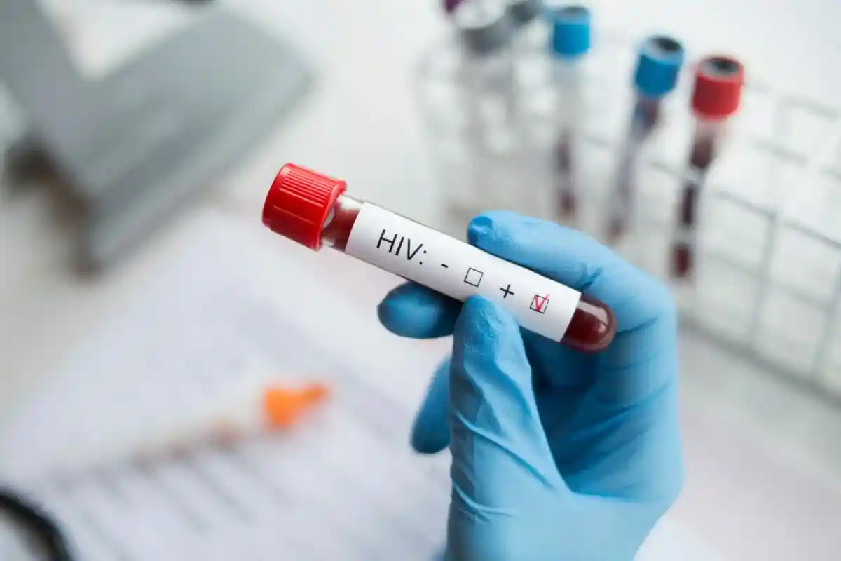 Как можно заразиться ВИЧ? Фото: mikeforemniakowski / Shutterstock.com