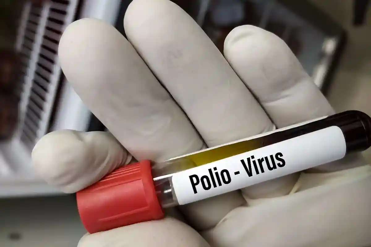 В США расширяется зона действия вируса полиомиелита