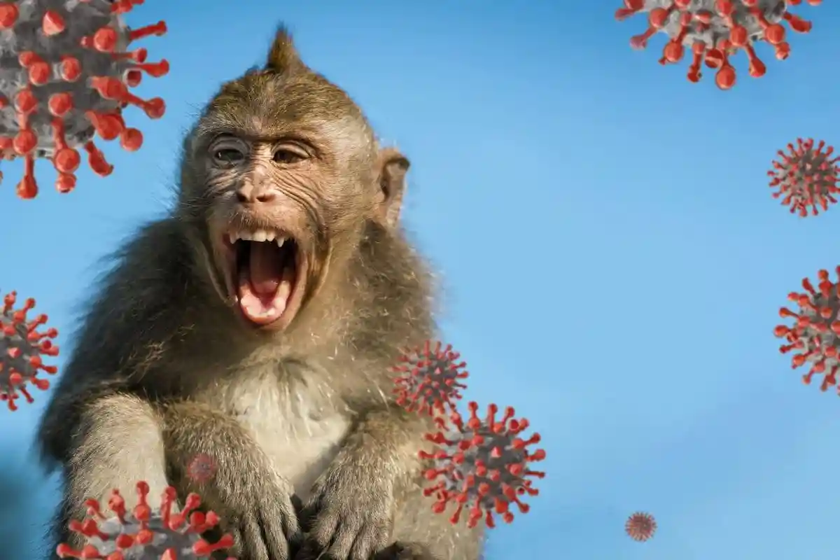 Техас подтвердил смерть больного обезьяньей оспой. Фото: KRITFOTO / shutterstock.com