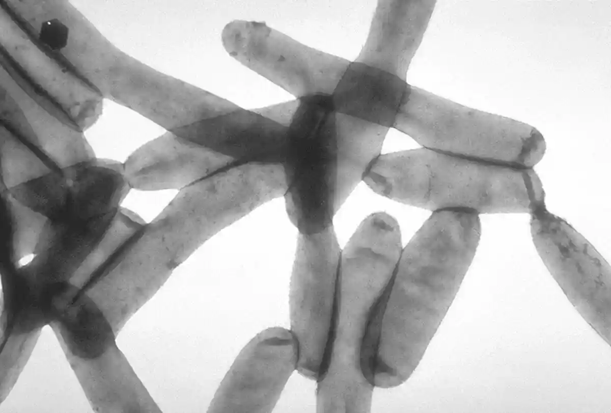 Бактерии легионеллы под микроскопом Фото: Public Health Image Library / wikipedia.org