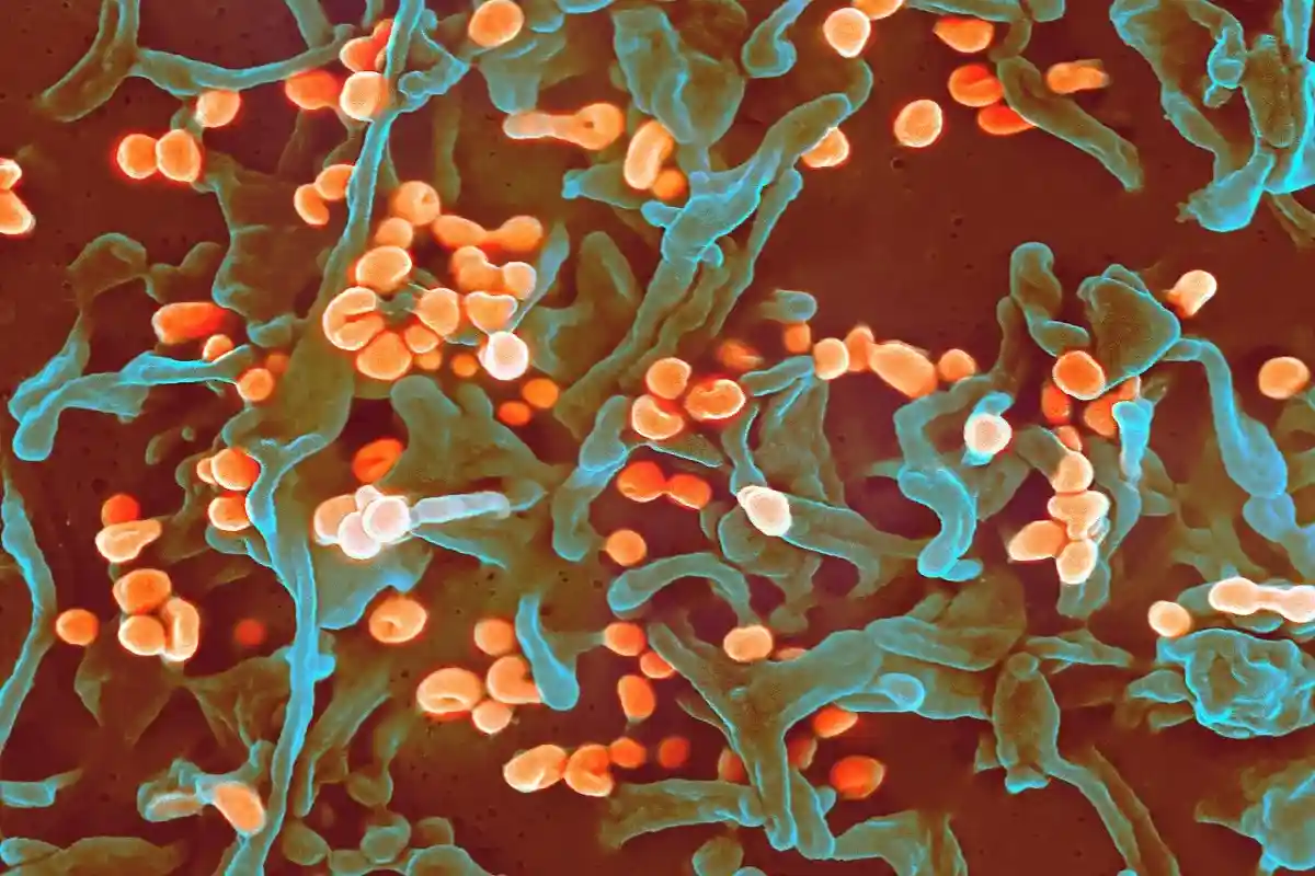 Вирус Ласса под микроскопом. Фото: NIH / commons.wikimedia.org