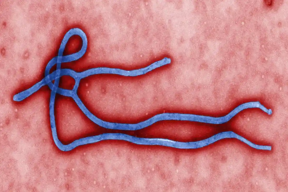 Вирус Эбола под микроскопом. Фото: CDC/Cynthia Goldsmith / commons.wikimedia.org