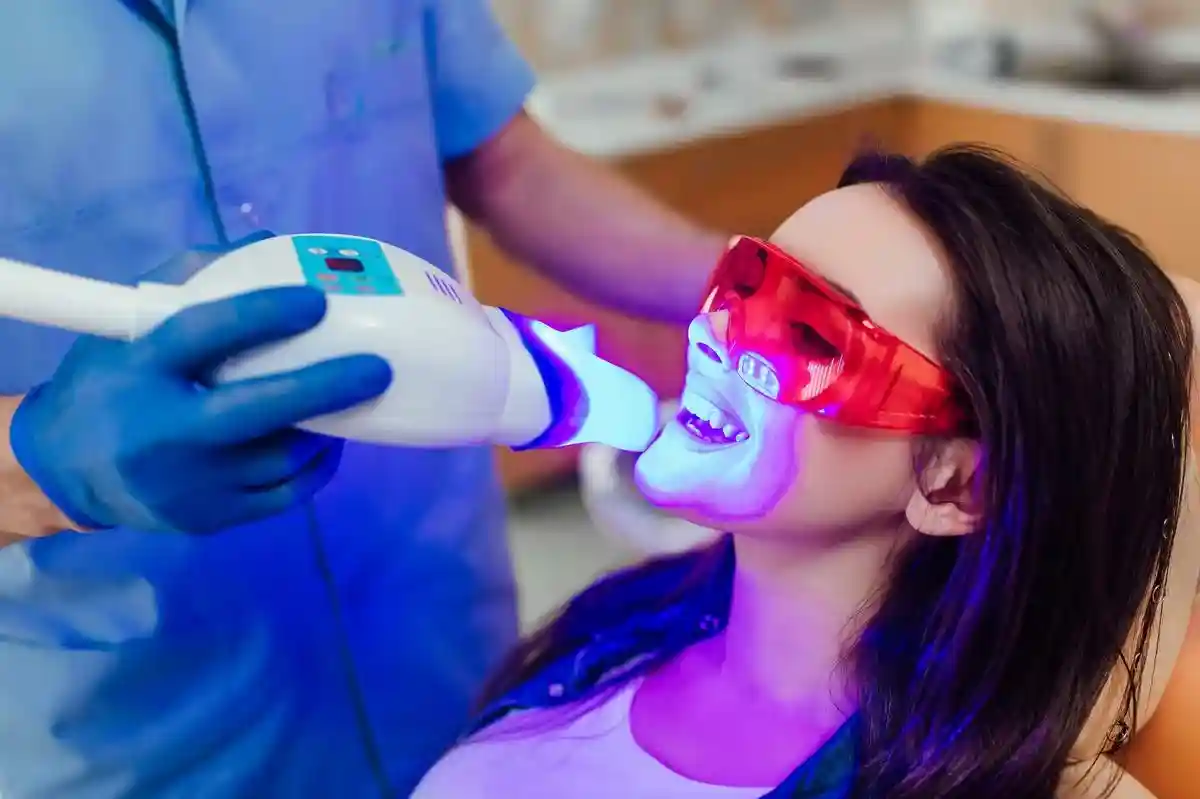 Как отбелить зубы дома и почему эта процедура не заменит визита к стоматологу. Фото: EZ-Stock Studio / shutterstock.com