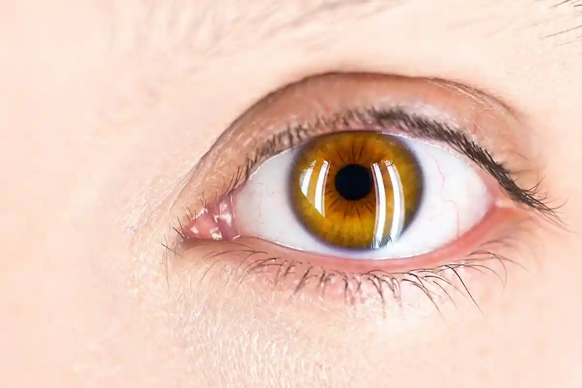 Синдром сухого глаза может символизировать о заболеваниях. Фото: Salvatore Ventura / Unsplash.com