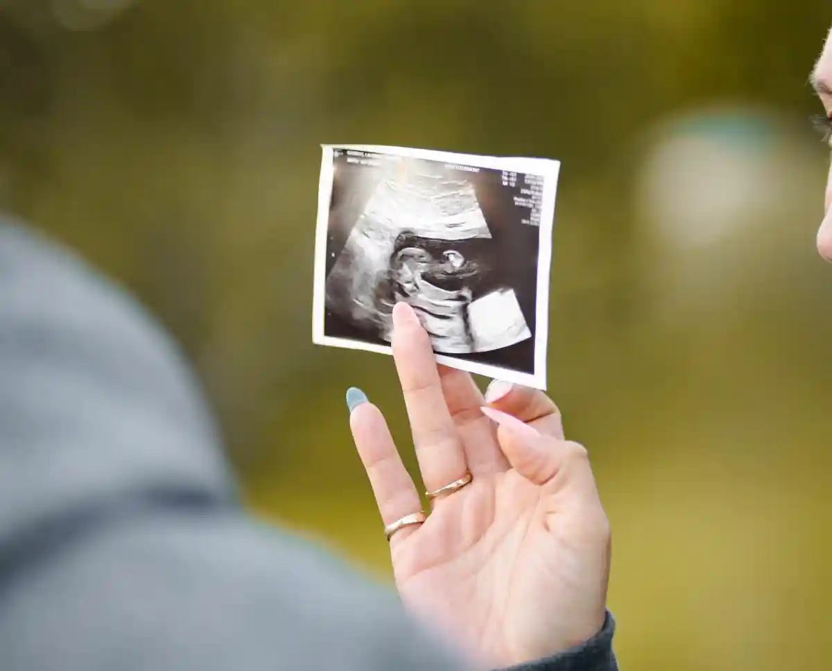 Исследователи использовали 4D-УЗИ для записи выражений лиц детей у 100 женщин на 32 и 36 неделе беременности. Фото: Dave Goudreau/Unsplash.com