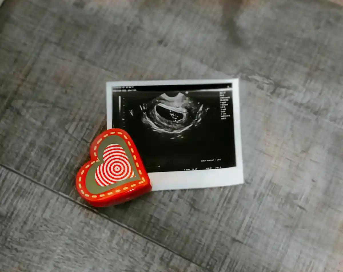 УЗИ используется несколько раз во время беременности. Фото: Viviana Rishe/Unsplash.com 