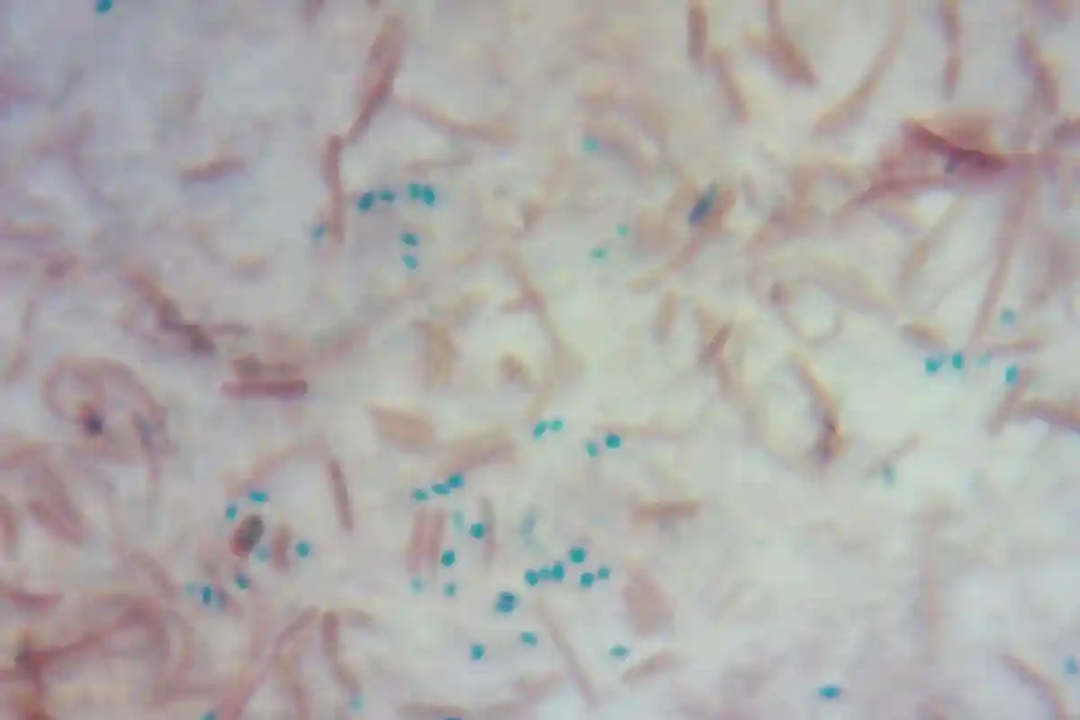Почему опасно подогревать рис: там могут образоваться бактерии типа Bacillus cereus. Фото: T. Nims / commons.wikimedia.org