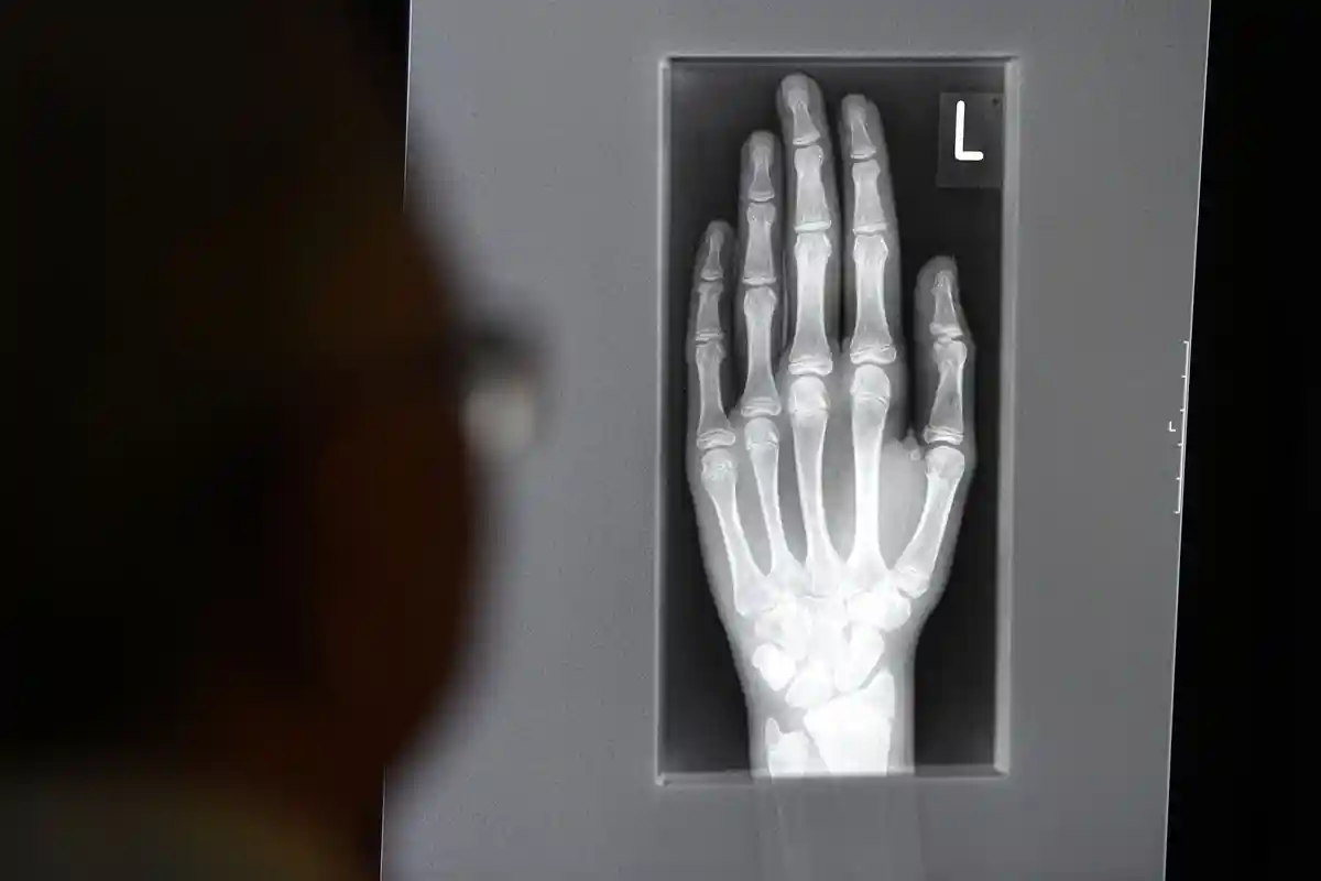 Революционер в медицине: Рентген умер 100 лет назад