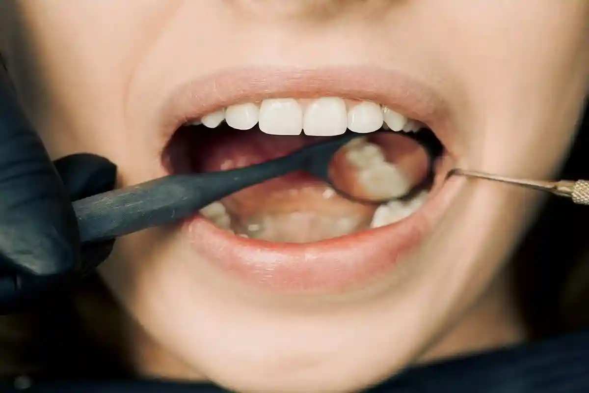 Плохие зубы вызывают отвращение у немцев. Фото: Arvind Philomin / pexels.com