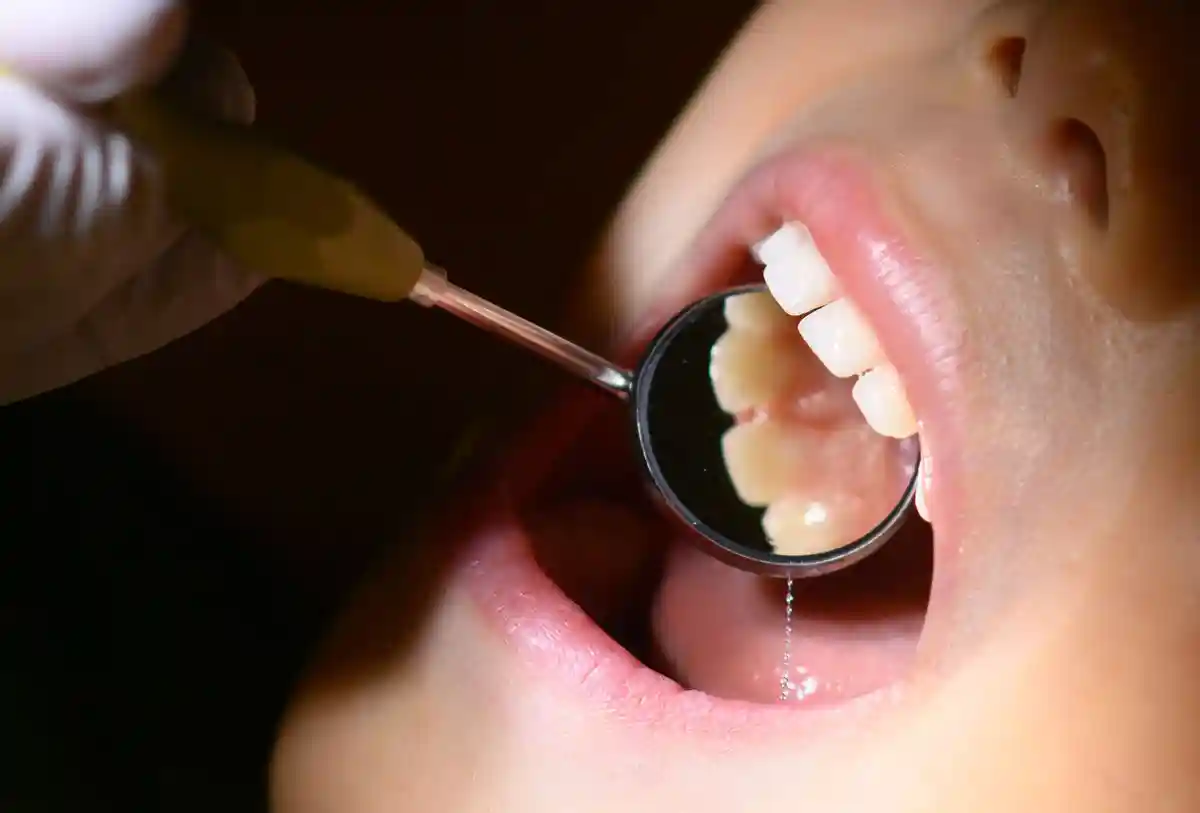 Barmer: нужно больше внимания детской стоматологии