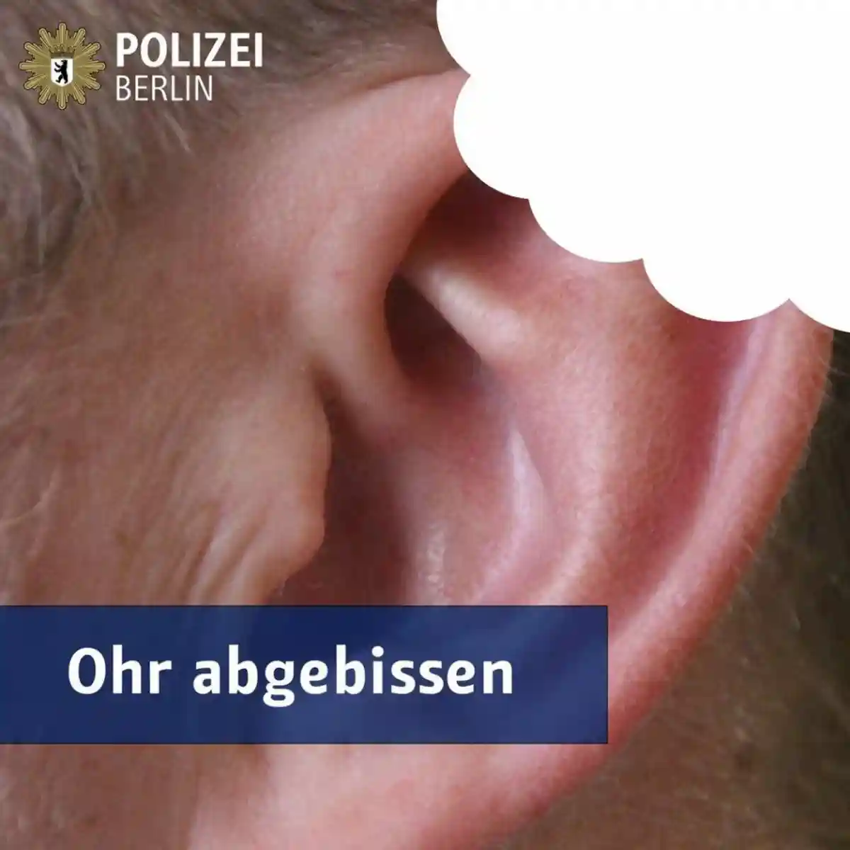 В берлинской электричке иностранец отгрыз пассажиру ухо фото 1